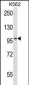 CARD10 Antibody (Center)