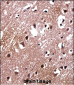 LDB2 Antibody (C-term)