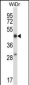 STEAP1 Antibody (N-term)