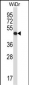 UQCRC2 Antibody (Center)