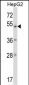 ZNF207 Antibody (N-term)