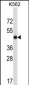 METAP2 Antibody (N-term)