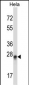 PEX19 Antibody (N-term)
