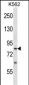 SENP5 Antibody (C-term)