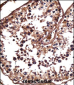 NANOS1 Antibody (Center)