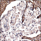 DSG2 Antibody (C-term)