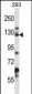 DSG2 Antibody (C-term)