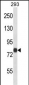 ACSL4 Antibody (N-term)