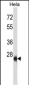 ZIC4 Antibody (N-term)