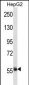 SP3 Antibody (Center)