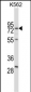 RPA1 Antibody (C-term)