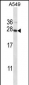 POLR2E Antibody (N-term)