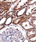 BIRC2 Antibody (Center)