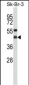 GNAI2 Antibody (N-term)