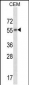 CHRM2 Antibody (Center)