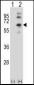 CHRM2 Antibody (Center)