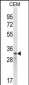 CCND2 Antibody (N-term)