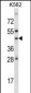 ADORA1 Antibody (C-term)