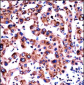 HRH1 Antibody (Center)