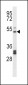 PTGIR Antibody (Center)