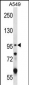 GRIK2 Antibody (C-term)