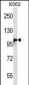 DSG1 Antibody (Center)