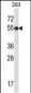 GTF2E1 Antibody (N-term)