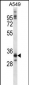 NKX6-1 Antibody (C-term)