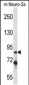 Mouse Irak1 Antibody (Center)