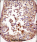 AKAP4 Antibody (N-term)
