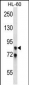 AKAP4 Antibody (N-term)