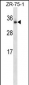 OTUB2 Antibody (N-term)