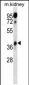 Mouse Hoxa1 Antibody (Center)