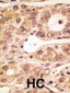 Mouse TLR5 Antibody (C-term)