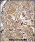 TLR6 Antibody (C-term)