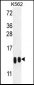 H4-K20 Antibody (N-term)