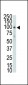 DDR2 (TYRO10) Antibody