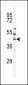 MST3 Antibody (C-term)