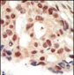 cGKII Antibody (C-term)