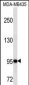 GSN Antibody (N-term)