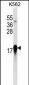 EIF4EBP1 Antibody