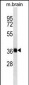 SYP Antibody (C-term)