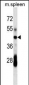 CD79A Antibody (C-term)