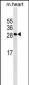 MYOG Antibody (N-term)