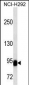 BCL6 Antibody (C-term)