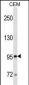 MME/CD10 Antibody