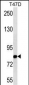 THOC1 Antibody (N-term)