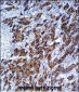 LGALS3 Antibody (C-term)