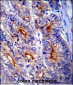 LGALS3 Antibody (C-term)