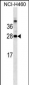 LGALS3 Antibody (C-term)